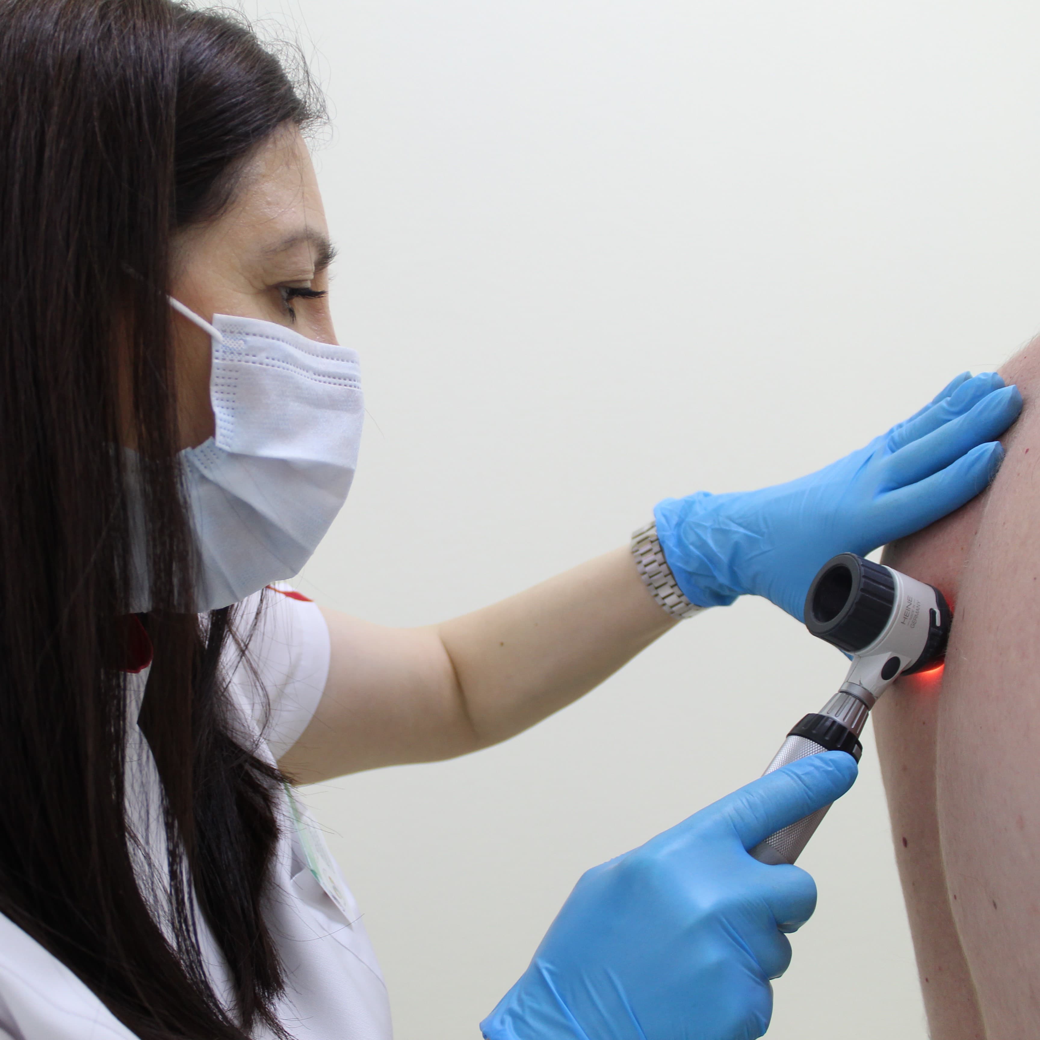 Проверь себя – не допусти меланому