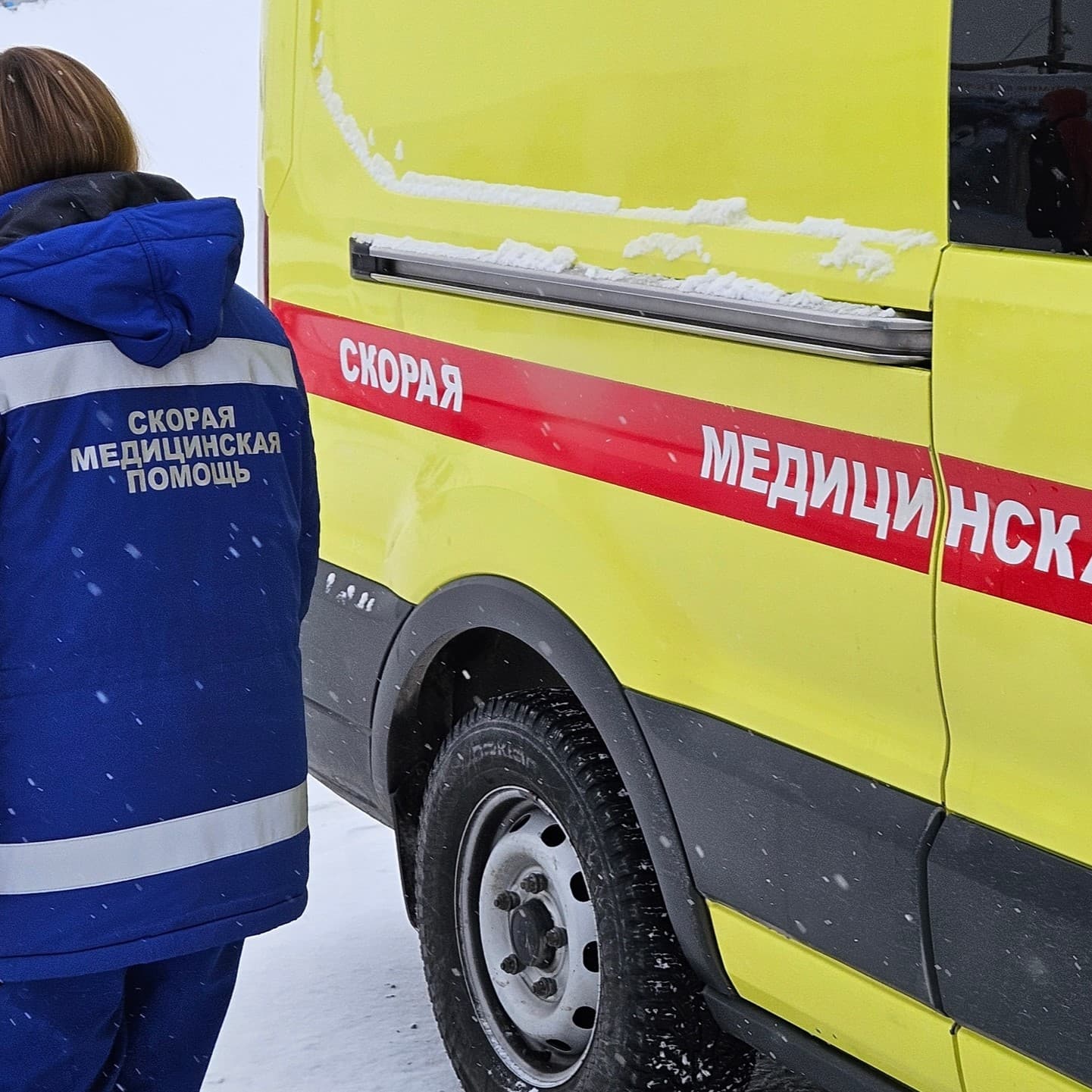 Ожог и масло: тюменец сделал хуже, пытаясь помочь себе сам